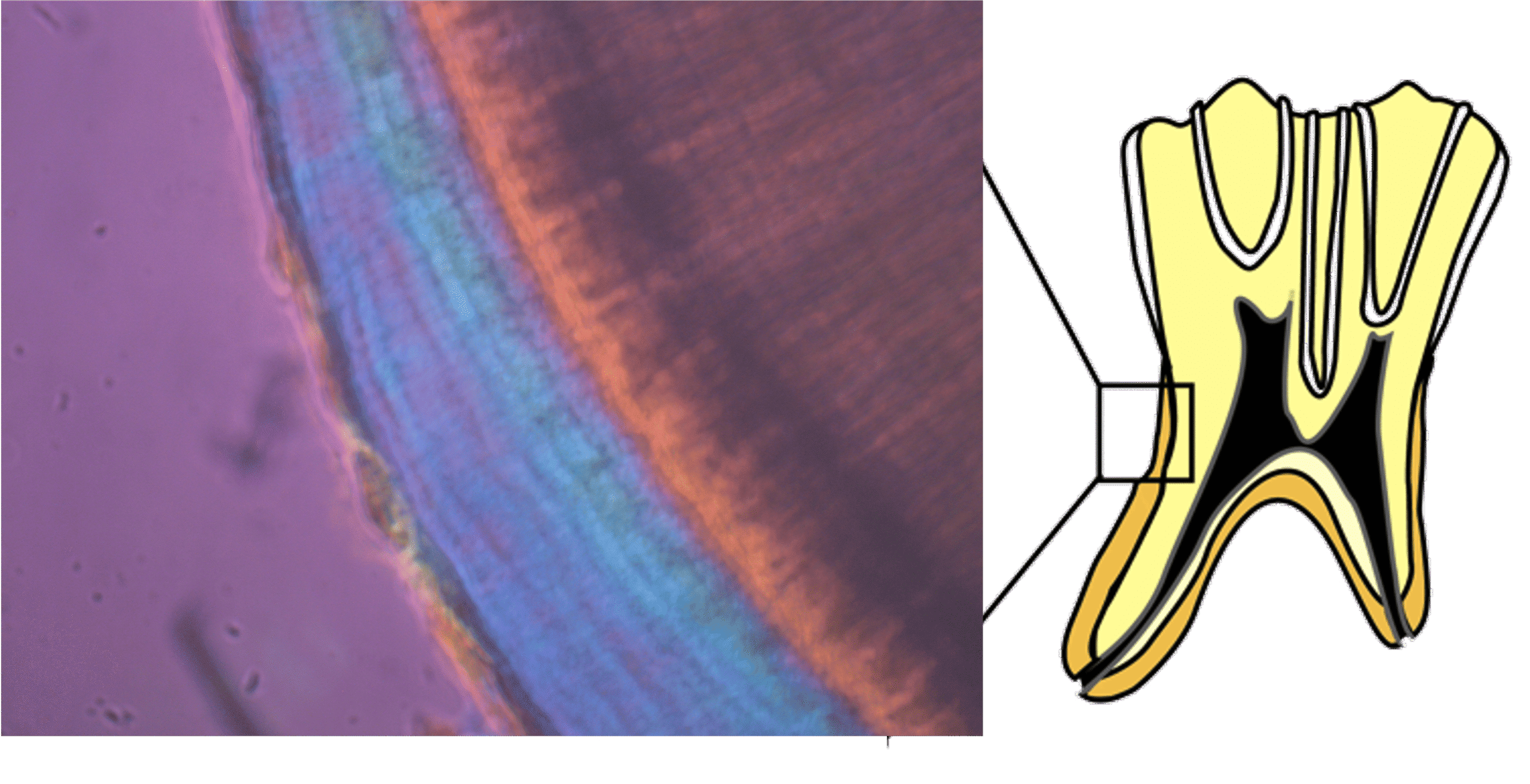 Cementum analysis image 1