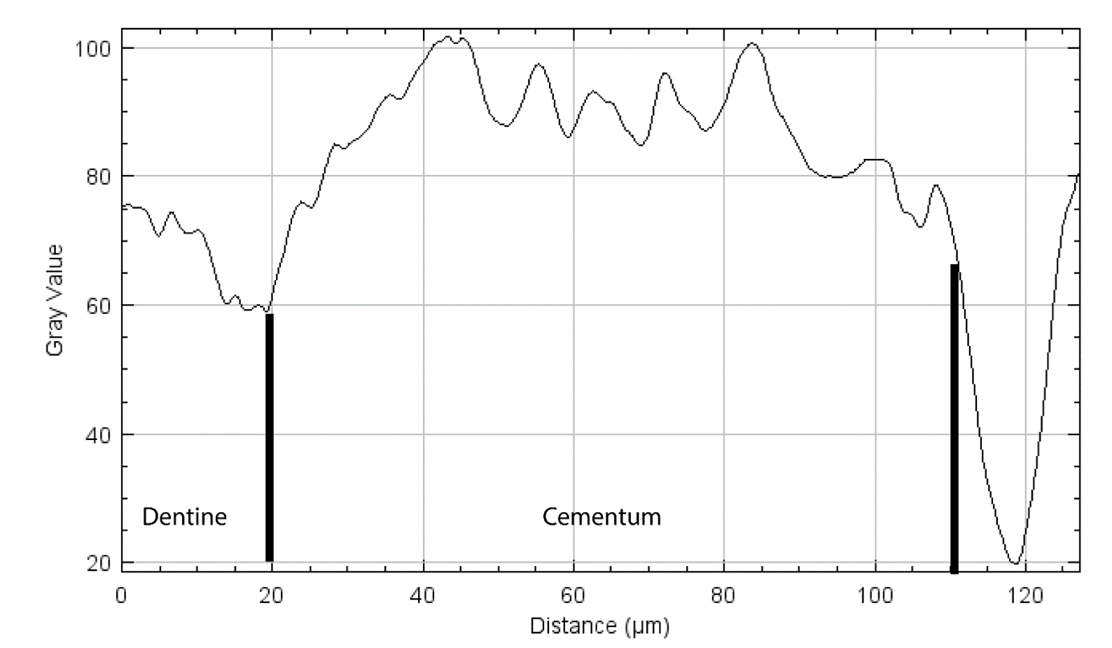 Computer analysis 3